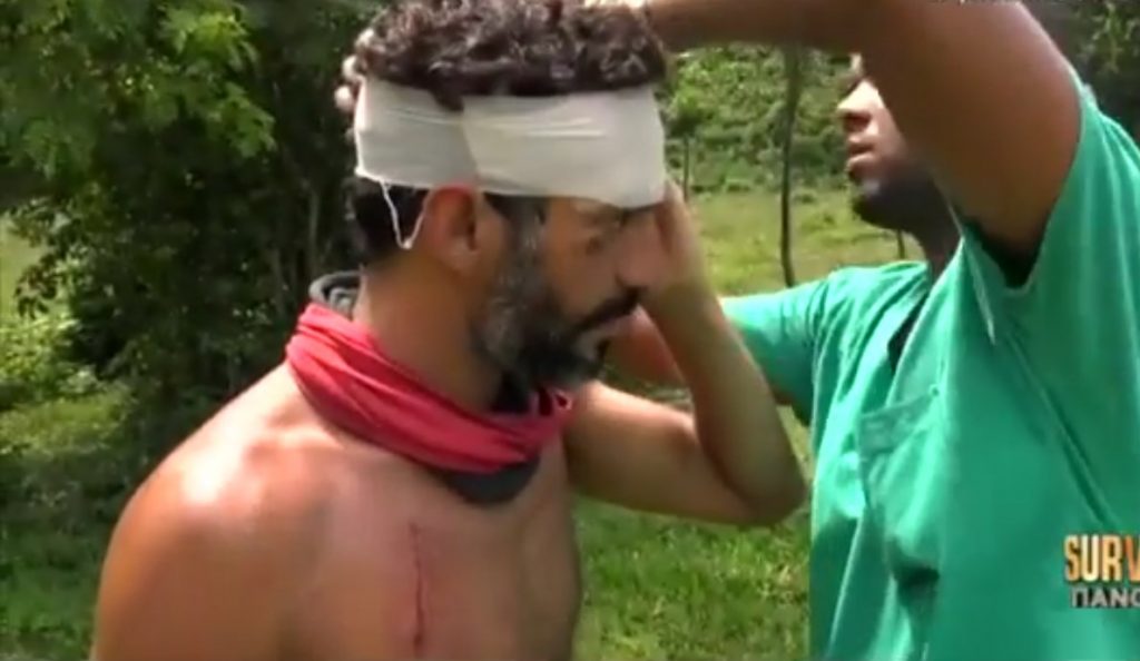 Survivor: Τραυματίστηκε στο κεφάλι ο Χρανιώτης – Δείτε πλάνα (vid) | Pagenews.gr Survivor: Τραυματίστηκε στο κεφάλι ο Χρανιώτης – Δείτε πλάνα (vid) | Pagenews.gr