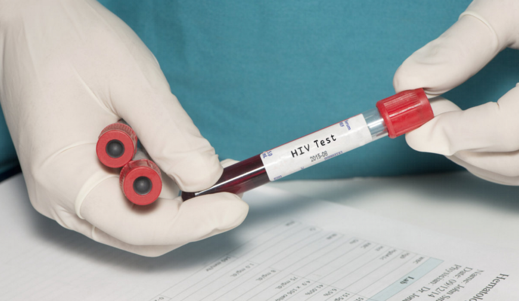 HIV: Μια νέα κάψουλα αργής αποδέσμευσης, μπορεί να απλοποιήσει τη θεραπεία του | Pagenews.gr HIV: Μια νέα κάψουλα αργής αποδέσμευσης, μπορεί να απλοποιήσει τη θεραπεία του | Pagenews.gr