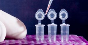 Τρόμος από παμπάλαιο ιό «ξάδελφο» του HIV | Pagenews.gr Τρόμος από παμπάλαιο ιό «ξάδελφο» του HIV | Pagenews.gr