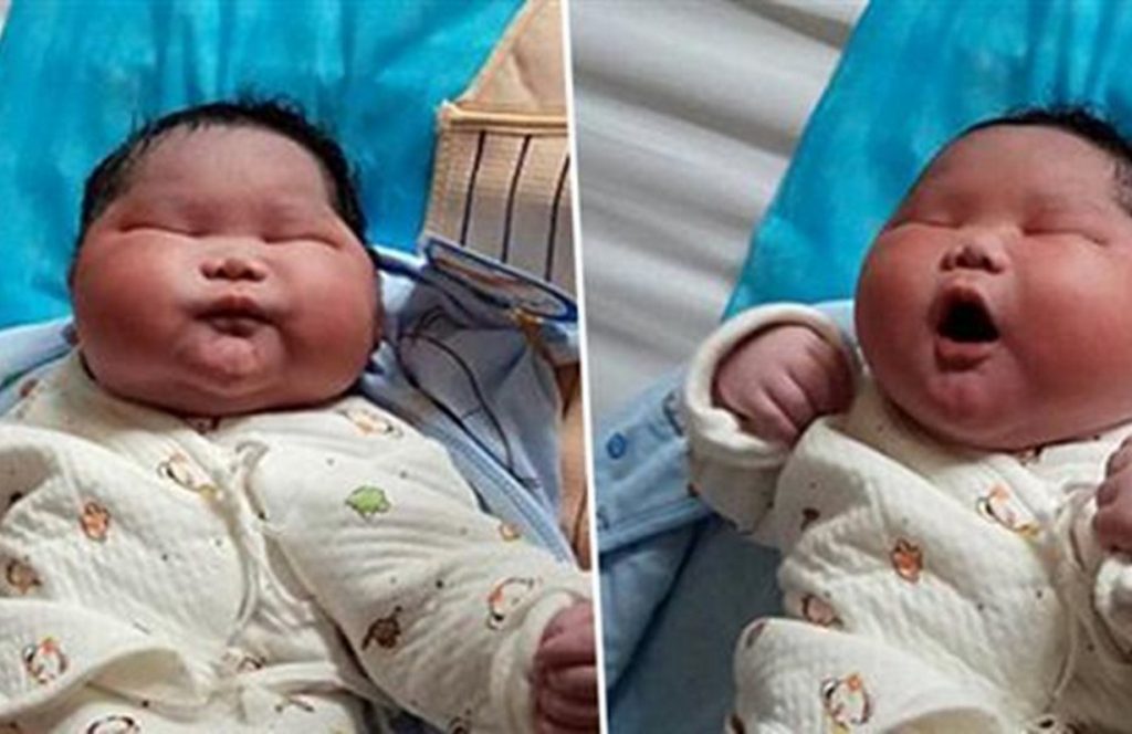 Viral: Παιδί στην Κίνα γεννήθηκε 7 κιλά. Οι φωτογραφίες που κάνουν τον γύρο του κόσμου | Pagenews.gr Viral: Παιδί στην Κίνα γεννήθηκε 7 κιλά. Οι φωτογραφίες που κάνουν τον γύρο του κόσμου | Pagenews.gr
