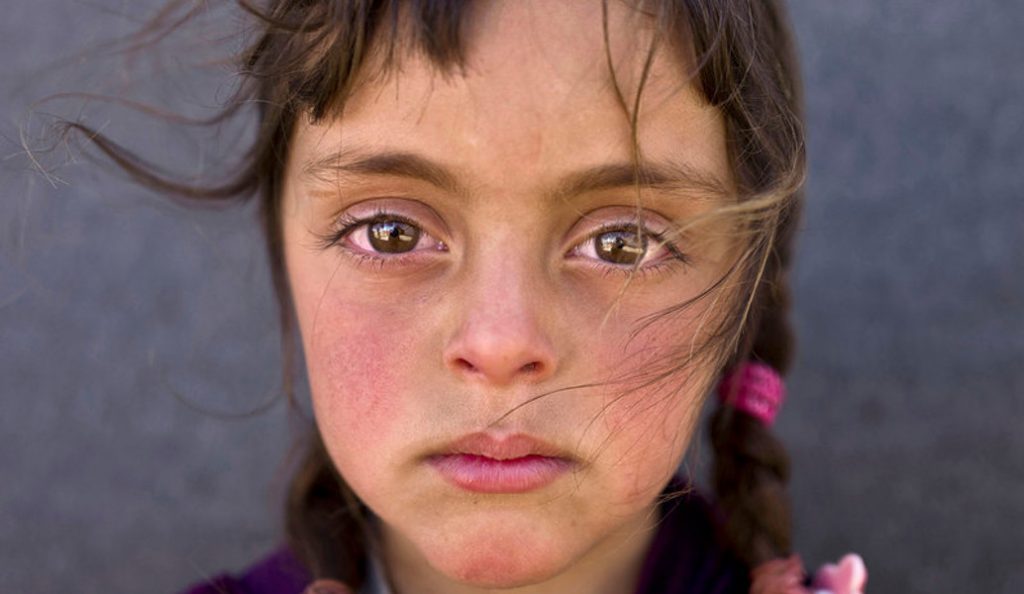 Unicef: Αυτή είναι η φωτογραφία της χρονιάς για το 2017 | Pagenews.gr Unicef: Αυτή είναι η φωτογραφία της χρονιάς για το 2017 | Pagenews.gr
