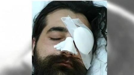 Επεισόδια στο ΟΑΚΑ: Οργή από τον οπαδό που έχασε το μάτι του – «Να βρεθεί ο υπαίτιος» | Pagenews.gr Επεισόδια στο ΟΑΚΑ: Οργή από τον οπαδό που έχασε το μάτι του – «Να βρεθεί ο υπαίτιος» | Pagenews.gr