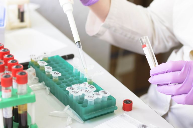 Έμπολα: Ελπίδες για θεραπεία της θανατηφόρας νόσου