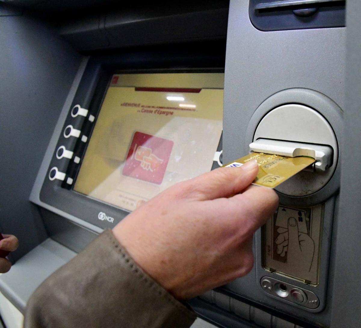 ATM epidoma paidiou