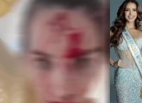 Φρίκη στις Κάννες: Γνωστός στυλίστας ξυλοκόπησε τη Μις Βενεζουέλα – Το σοκαριστικό βίντεο